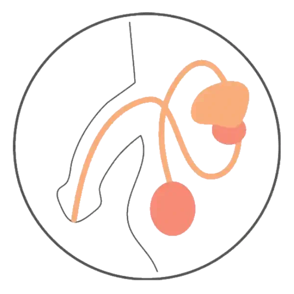 rts radthesys fiber prostate gland